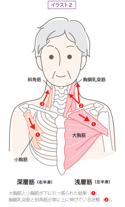 筋解剖学 レッスン No 1 セラピスト誌年6月号より Massage Therapy Institute
